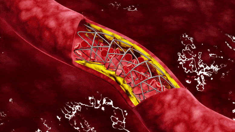 blood_vessels_animated_grafioo